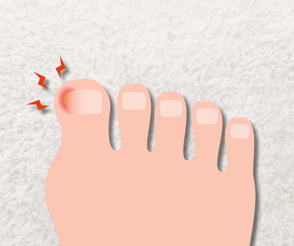cartoon foot with ingrown toenail